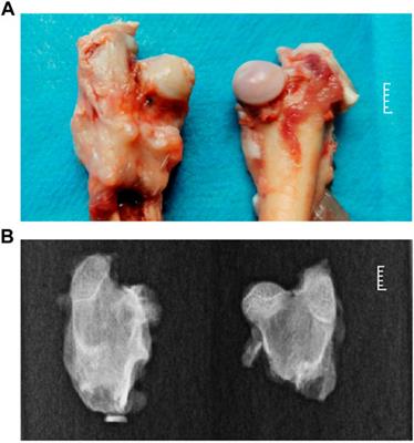 Construction of ceRNA network based on RNA-seq for identifying prognostic lncRNA biomarkers in Perthes disease